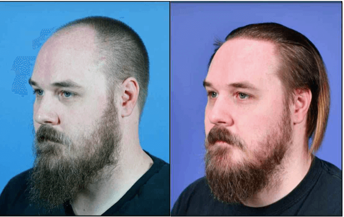 Image Title My Image